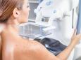 Perch con il seno denso non basta la sola mammografia per scoprire un eventuale tumore