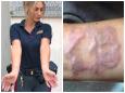 Arianna Virgolino  espulsa dalla polizia per un tatuaggio (rimosso): «Carte false dietro al mio calvario»