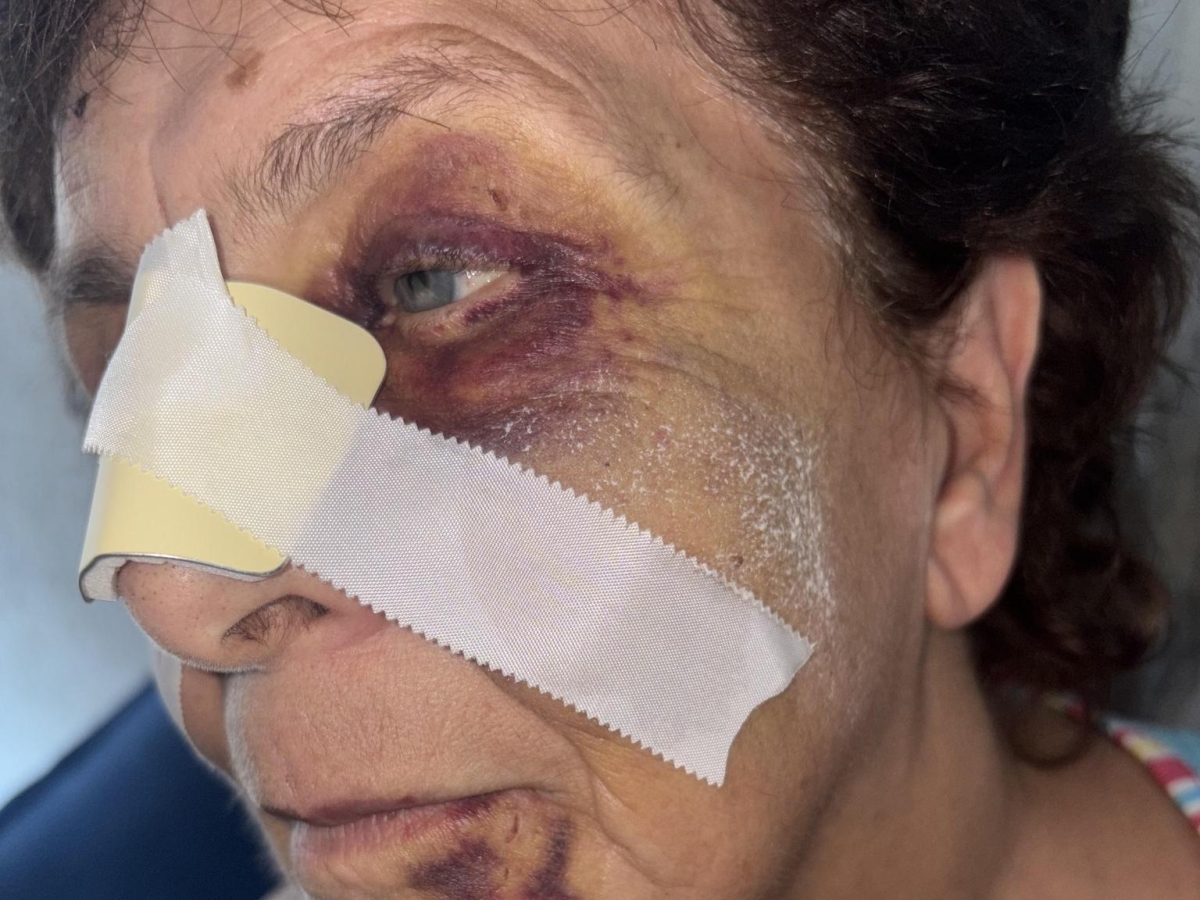 Napoli, due anziani travolti da uno scooter: «Mia nonna ha fratture multiple, lui rischia la vita. Un attraversamento si è trasformato in un inferno»