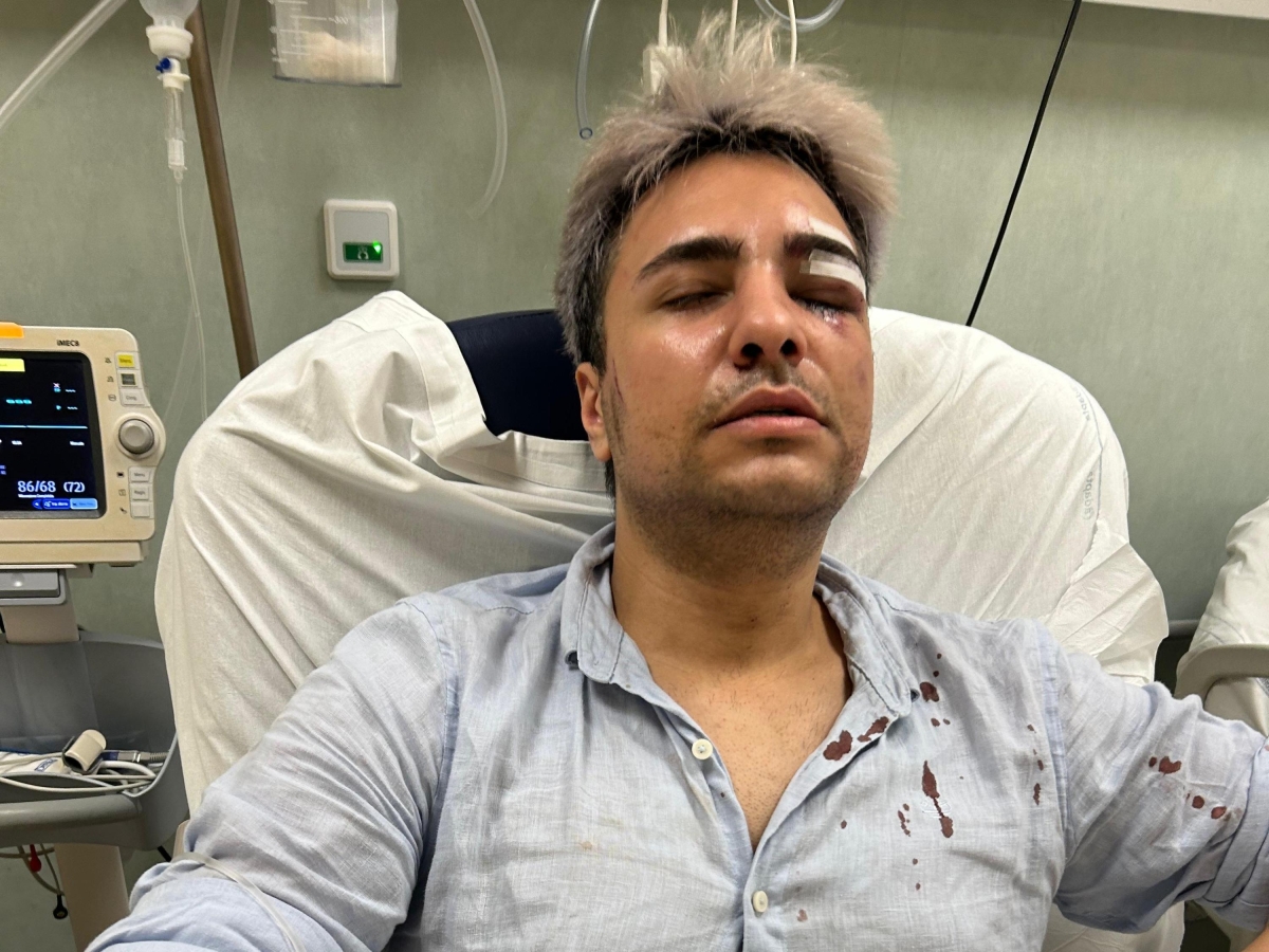 Roma, aggressione omofoba in centro: «Fr... dammi il ventaglio». Poi il pestaggio e gli sputi