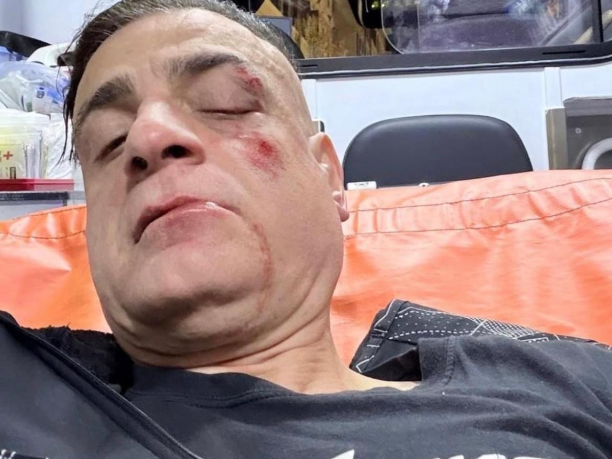 Lo youtuber Simone Cicalone aggredito nella metro Ottaviano. Caccia a un gruppo di borseggiatori