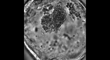 Lung organoids showing function of cilia