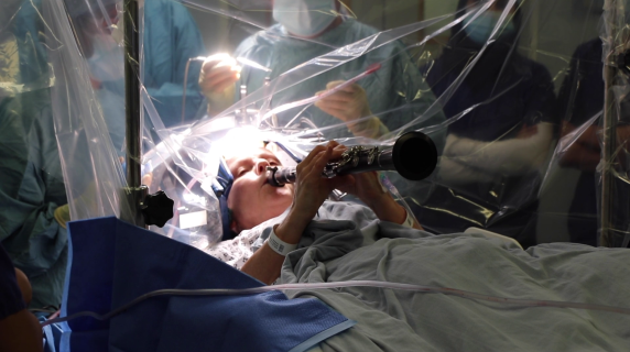 La donna operata al cervello a Londra mentre suona il clarinetto