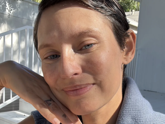 Bianca Balti: la depressione estiva e il supporto salvifico di una psico‑oncologa