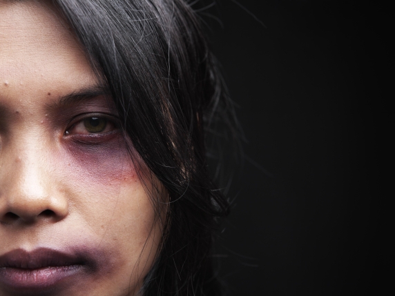 Violenza contro le donne: lacune nei servizi sanitari e conseguenze a lungo termine