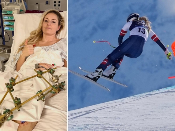 Vonn confirms third surgery success