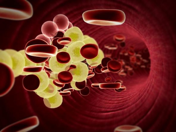 Nuove speranze per il colesterolo: terapie innovative per un futuro più sano