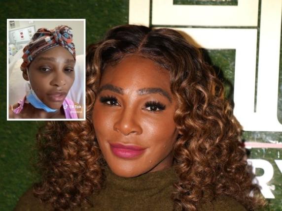 Serena Williams operata al collo: «Cisti grande come un pompelmo». Cosa è successo