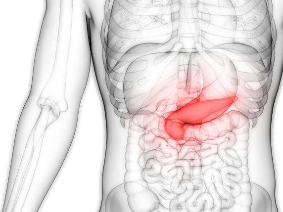 Tumore al pancreas, ancora molto difficile guarire ma si guadagna tempo per i pazienti. Otto casi su dieci scoperti tardi