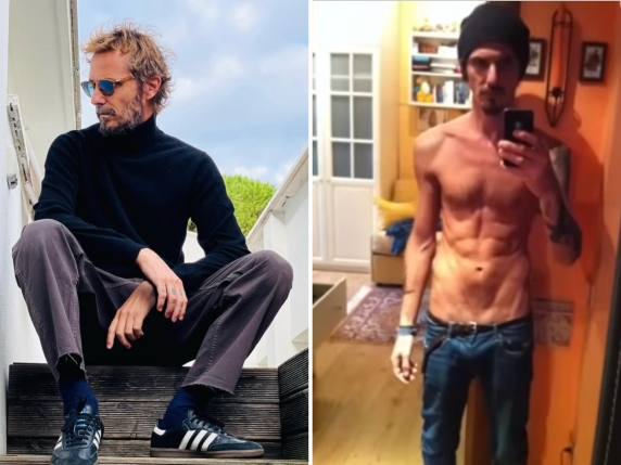 Laerte Pappalardo racconta la sua lotta contro l'anoressia dopo la partecipazione a L'Isola dei Famosi