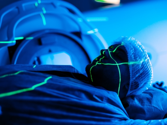 Radioterapia: 70 % dei pazienti non riportano effetti collaterali significativi, secondo uno studio