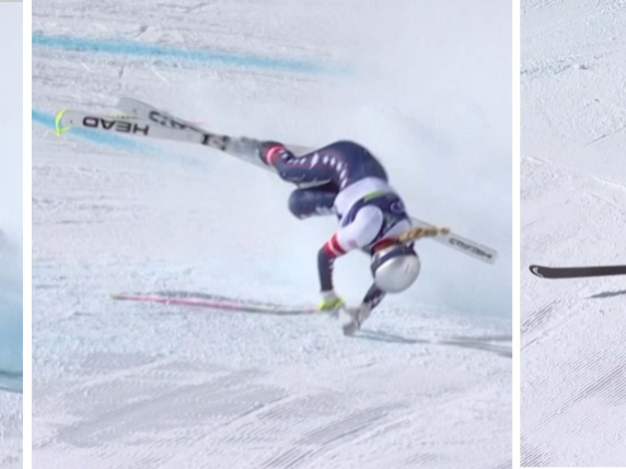 Vonn operata per frattura scomposta alla gamba. La sorella: «L’ultima cosa che avrei voluto vedere» | L'infortunio choc