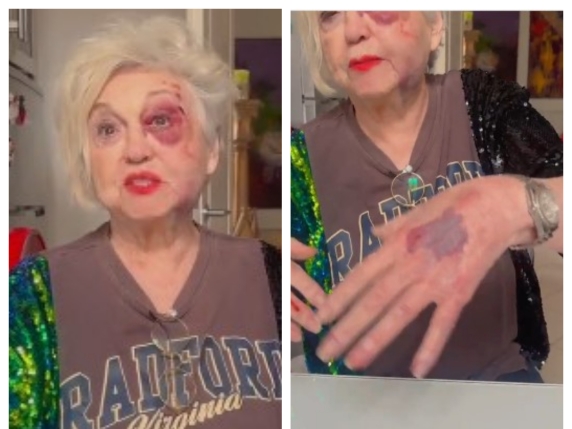 Wanna Marchi investita da un'auto a Milano: «Ero sulle strisce, sono devastata. Ma non cercherò risarcimenti»