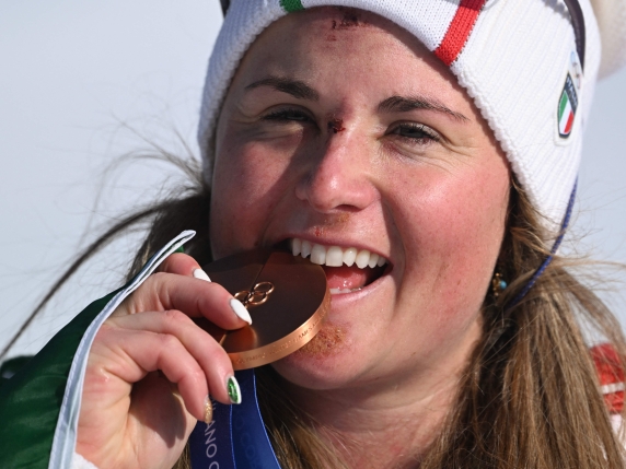 Moioli, regina dello snow: le ferite sul volto, gli studi e la passione per il surf