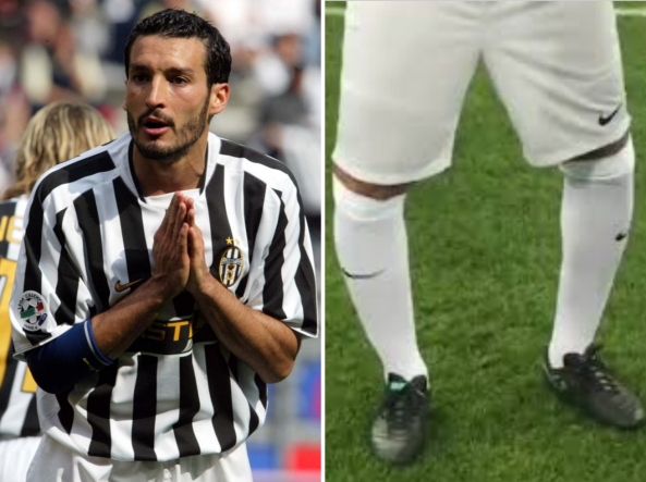 Zambrotta e le gambe curve: «I chirurghi si chiedono come faccia a  camminare. Mi opero, poi dovrò mettere una protesi totale» | Corriere.it