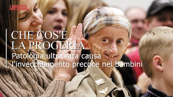 Progeria, cosa è la malattia di Sammy Basso