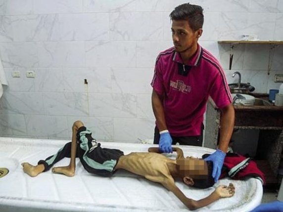 Cibo e aiuti col contagocce, chi li cerca rischia la vita: a Gaza si muore (anche) di fame