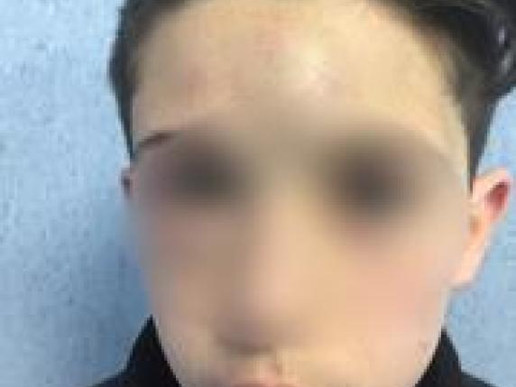 Napoli, 13enne aggredito da bulli:i genitori postano foto choc su Fb