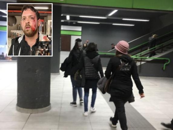 Matthia Pezzoni Aggredito Dalle Borseggiatrici In Metrò A Milano Mentre ...