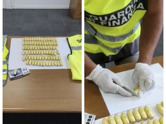 Bologna, Dal Brasile Con 101 Ovuli Di Cocaina Nello Stomaco: Arrestata ...