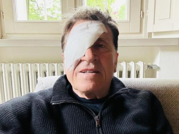 Gianni Morandi, mistero sulla foto sui social con una benda sull’occhio: “Ho fatto a pugni”