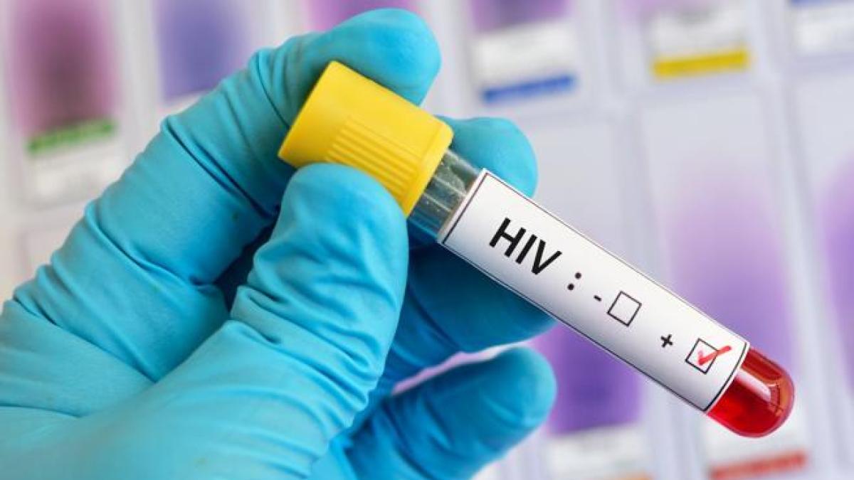 Hiv, 16 anni del programma «Easy test»: «Portiamo gli screening al di ...