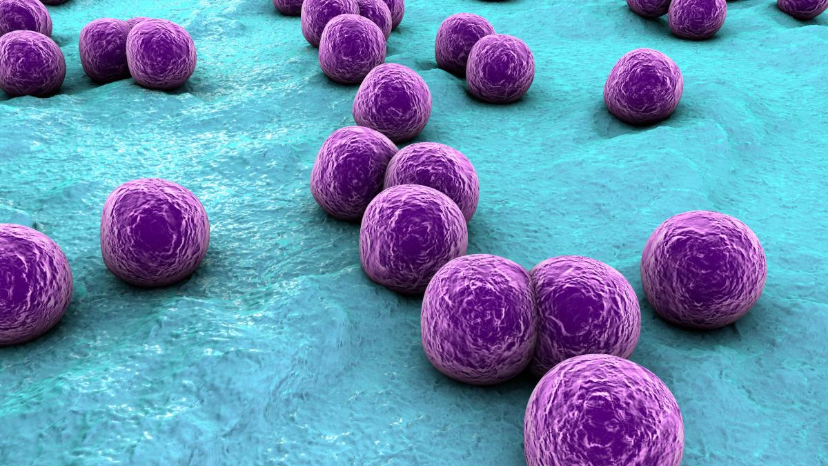Post-operative infections, the main cause could be skin bacteria