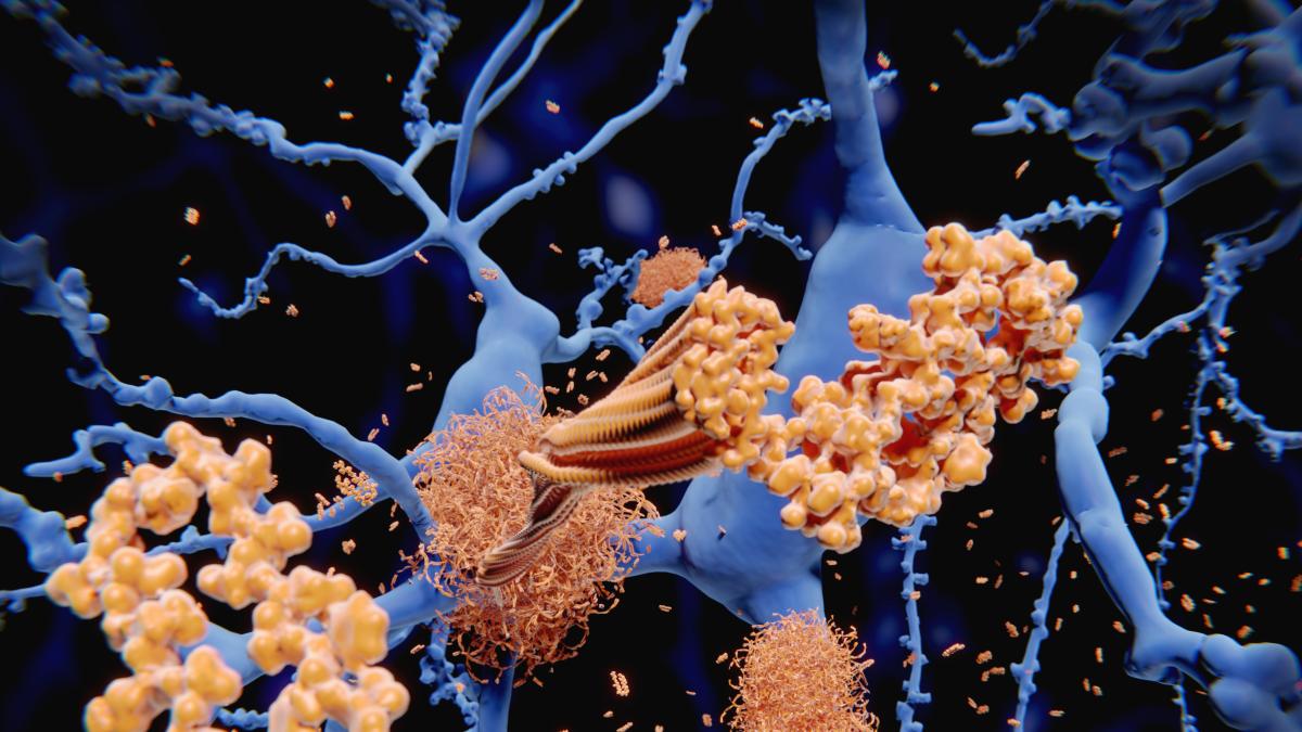 The gene that protects against Alzheimer’s: «It creates a barrier in the brain»