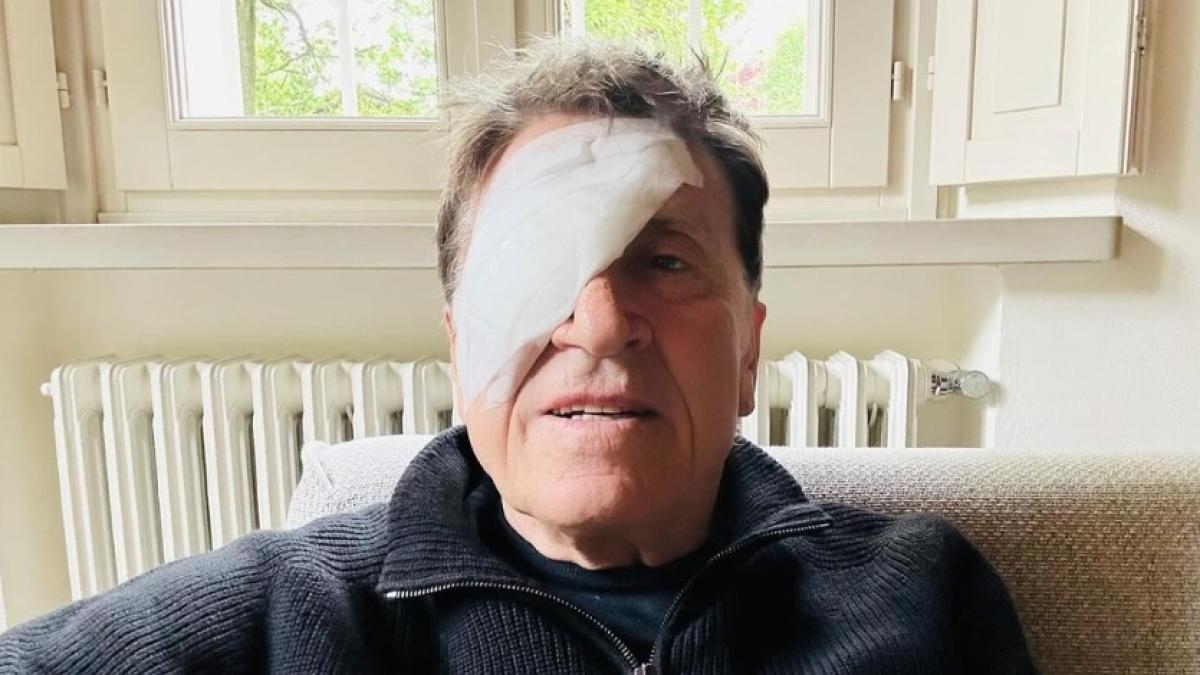 Gianni Morandi, o mistério da foto que circula nas redes sociais dela usando tapa-olho.  “Briguei”, brinca, mas na verdade foi operado