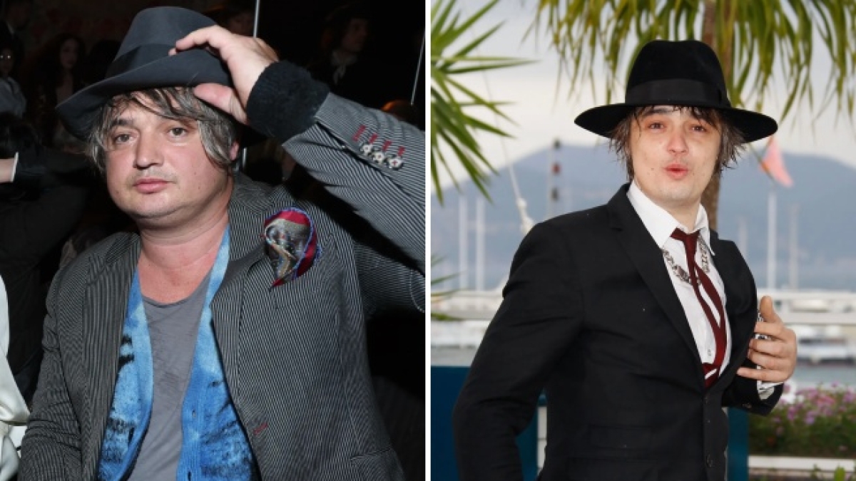 Pete Doherty rischia l'amputazione delle dita dei piedi. Il cantante dei Libertines ha di diabete di tipo 2 e deve esibirsi su una sedia