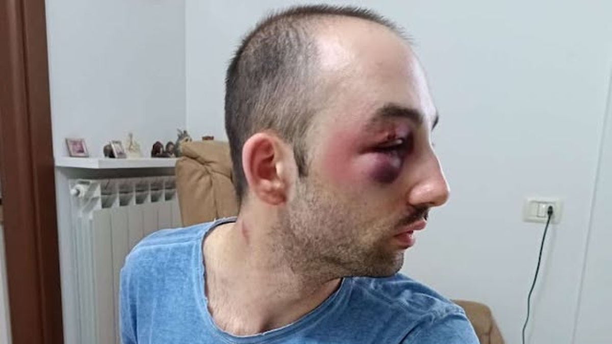 Varese, architetto 30enne aggredito dal «branco» al parco Molina: lo picchiano, poi scappano con la sua auto