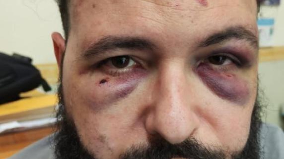 Fotografo aggredito per la spilla antifascista, tensione al processo