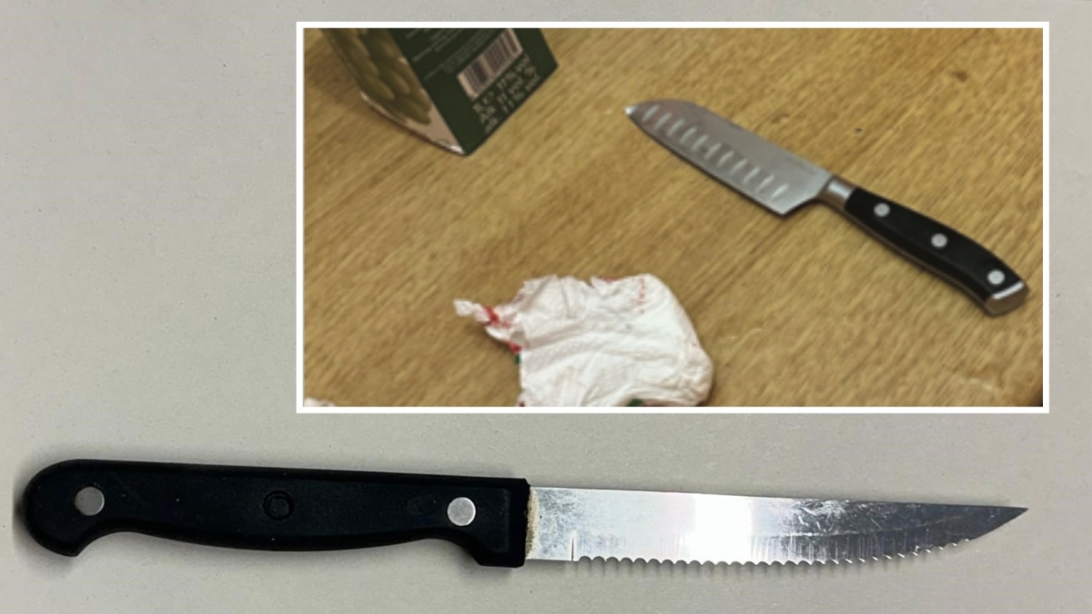 Tentato omicidio nel Mantovano: 58enne ferisce il coinquilino alla gola con un coltello da cucina