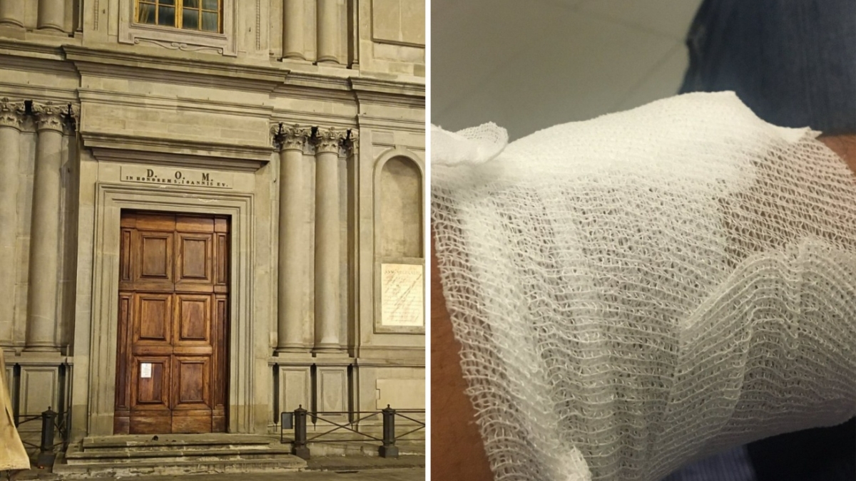 Aggredito in centro a Firenze, la denuncia di Alessio Calamandrei: «Io al pronto soccorso fino all'alba, quell'uomo era libero dopo un’ora»