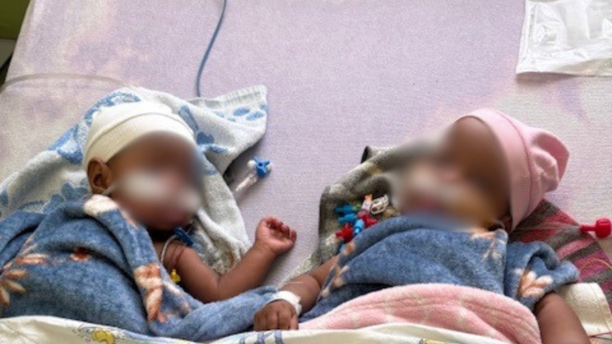 Da Massa all'Eritrea, i medici di Monasterio salvano due gemelline di 9 mesi