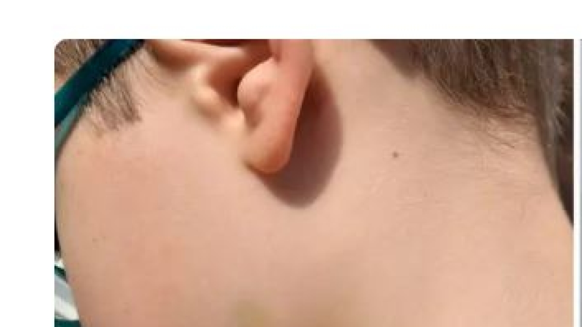 Uccide il figlio di 9 anni tagliandogli la gola. All