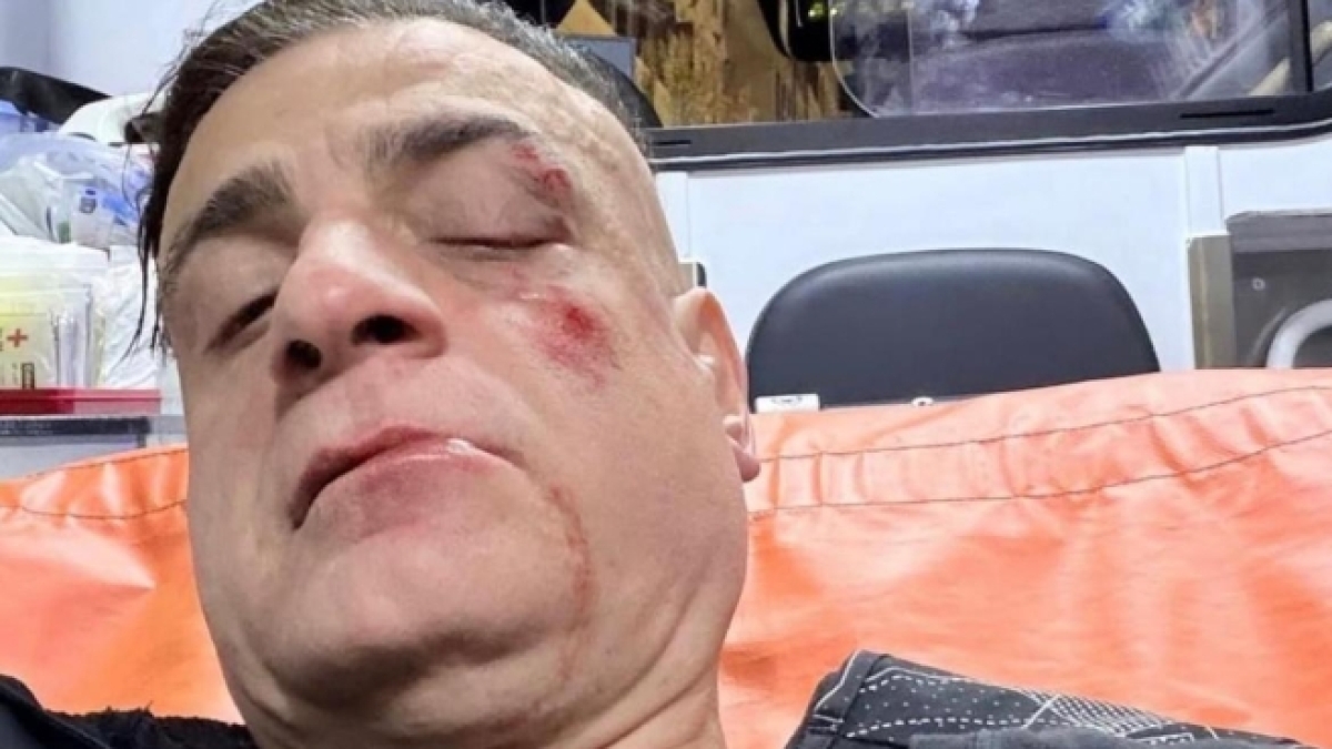 Cicalone davanti alla Commissione d'inchiesta sulle periferie a Roma: «Il boss che mi ha fatto picchiare mi ha invitato a una diretta video»