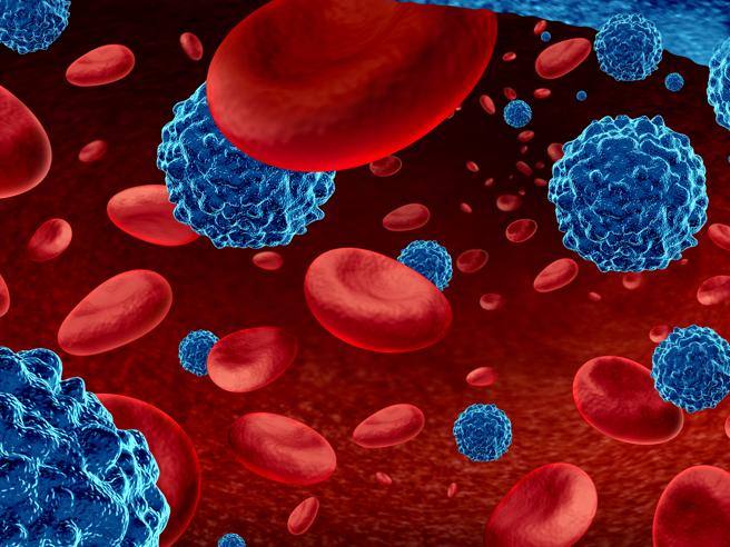 Linfoma diffuso a grandi cellule B, disponibile una nuova cura per i pazienti già sottoposti a due o più linee di terapia