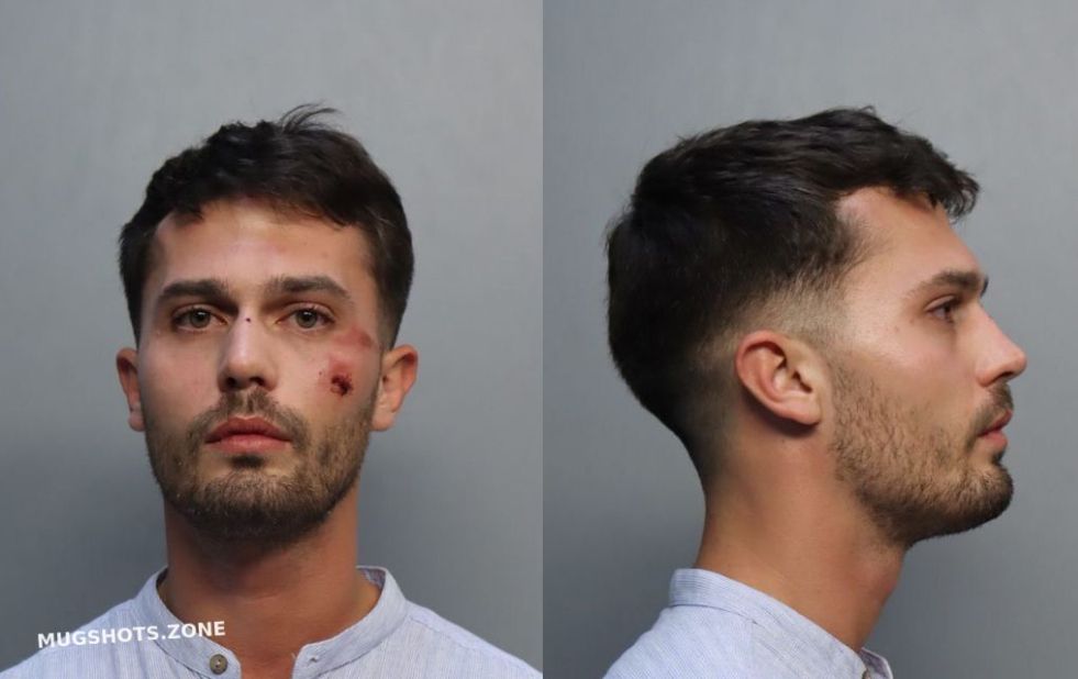 Matteo Falcinelli, la lite, l’arresto, le violenze dopo ore in carcere a Miami: «Sopravvissuto alle torture»