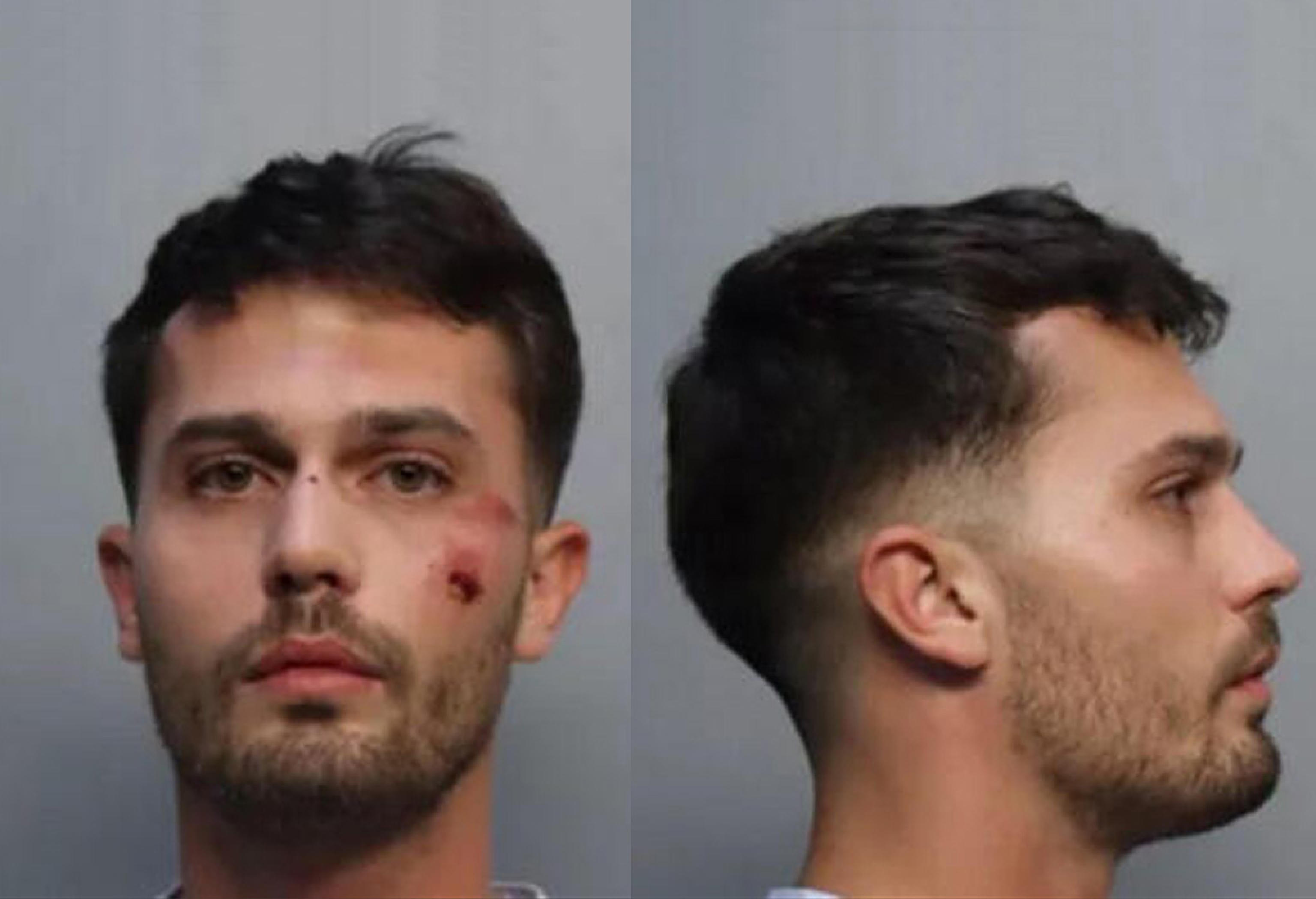 Matteo Falcinelli, legato e immobilizzato a Miami (combo)