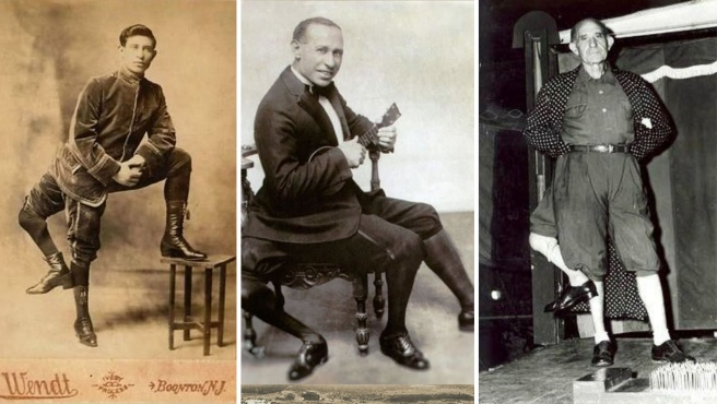 La vera storia del «maravigghiusu» Frank Lentini, nato in Sicilia con tre gambe e diventato ricco in America