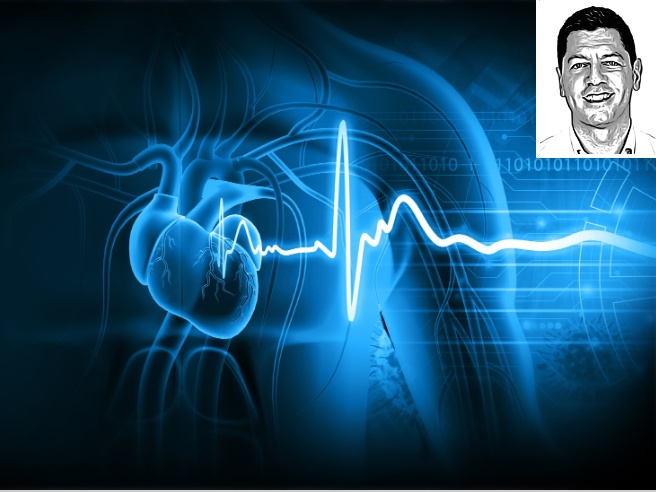 Sindrome di Brugada: diagnosi, cure e i controlli da fare | Corriere.it